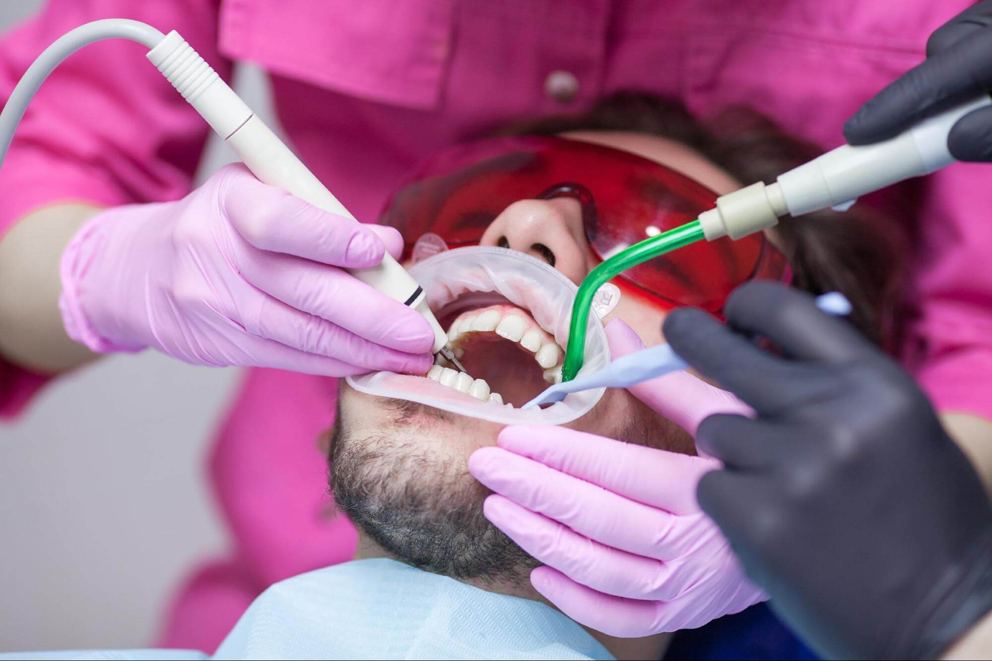 How much does a root canal cost? Somos Dental Laveen