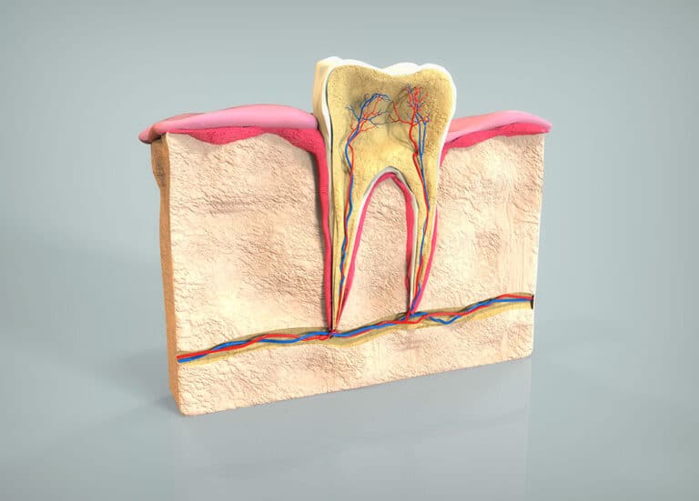 root-canal-recovery-time-02